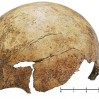Cráneo de un niño encontrado en el yacimiento paleolítico de Schöneck-Kilianstädten, en Alemania, con restos evidentes de haber sido golpeado violentamente.