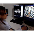 Imagen de unos pulmones en la clínica Santa Ana de León. MARCIANO PÉREZ
