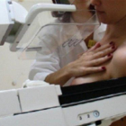 Una mujer realiza una mamografía a otra.