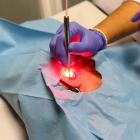 Operación en el servicio de Dermatología del Hospital de León