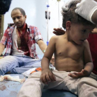 Un niño yemení recibe tratamiento tras resultar heridos en los combates.