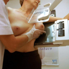 El programa de detección precoz de cáncer de mama se sustenta en las mamografías.