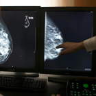 Una mamografía en 3-D.