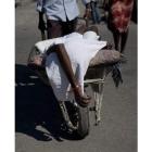 Una persona con síntomas de cólera en Haití.