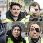 Algunos de los manifestantes chalecos amarillos que acusan a la policía francesa de sus heridas.
