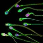 La esterilidad de una de cada cuatro parejas se debe a alteraciones en los espermatozoides
