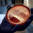 Vista de un cultivo de listeriosis en una placa de Petri, este jueves en el Laboratorio de Listeriosis del Centro Nacional de Microbiología de Madrid. CHEMA MOYA