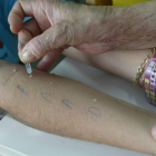 Las pruebas de la alergia se hacen en los meses de otoño.