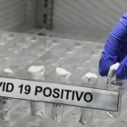 Una enfermera organiza muestras positivas de coronavirus de pacientes. CARLOS ORTEGA