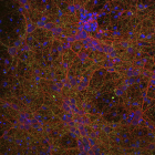 Imagen de los circuitos neuronales. DL
