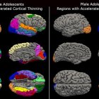 Una nueva investigación del Institute for Learning & Brain Sciences, o I-LABS, de la Universidad de Washington, descubrió que los confinamientos durante la pandemia de Covid-19 provocaron una maduración cerebral inusualmente acelerada en los adolescentes que fue más pronunciada en las mujeres, como se ve a la izquierda. Fotografía facilitada por I-LABS de la Universidad de Washington. EFE