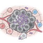 Células bacterianas artificiales (púrpura) activan varias partes del sistema inmunitario para atacar a las células tumorales (gris). Crédito: Universidad de Columbia