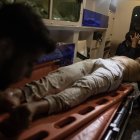 Un palestino es trasladado en ambulancia al hospital de Nasser tras los últimos bombardeos de Israel en la Franja de Gaza en el que al menos 15 palestinos han muerto y varios han resultado heridos. EFEHaitham Imad / ATENCIÓN EDITORES CONTENIDO GRÁFICO