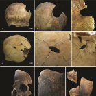 Ejemplos de traumatismo craneal. Arriba) lesión perimortem en la parte posterior izquierda del hueso frontal (a), también pueden verse marcas de corte en el hueso frontal (b) y el bisel patinado de la superficie craneal interna es evidente alrededor de la lesión (c); centro) cráneo con una lesión perforante en el hueso frontal medio (d), una vista más cercana muestra líneas de fractura radiales (e) y la vista interna muestra el bisel patinado (f ); inferior) cráneo de adulto (g), una inspección más cercana muestra marcas de corte a lo largo del frontal medio (h) y una fractura perimortem por objeto contundente en el fragmento de hueso frontal derecho contiguo (i) Crédito: Schulting et al. Antiquity, diciembre de 2024.
