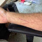 Brazo de Frank Cuesta tras el ataque.