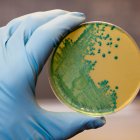 Listeria monocytogenes que crece en una placa de agar. Fotografía faclitada por el CSIC. Envato. EFE