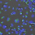 Macrófagos de ratón tratados in vitro con el compuesto MACTIDE-V que han sido expuestos a células de cáncer de mama (en verde). Fotografía facilitada por el CSIC / Pablo Scodeller. EFE