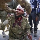 Un herido en los choques en Siria.