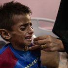 Osama al-Raqab, de 5 años, uno de los niños palestinos que sufre desnutrición severa.