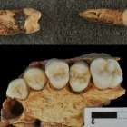 Estudio dental realizado en Atapuerca.