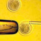 Transferencia del núcleo de una célula adulta a un óvulo enucleado.