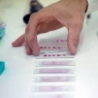 Pruebas de alergia para detectar el alergeno.