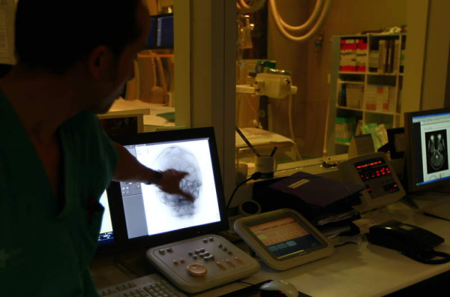 La sala de radiología intervencionista dispone de la tecnología necesaria para realizar la fribinolisis intraarterial en pacientes con tejido cerebral recuperable.