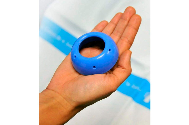 Imagen del anillo de silicona que se coloca en el útero.