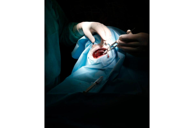 Intervención quirúrgica. jesús f. salvadores