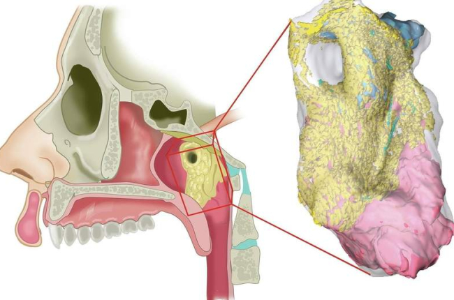 Resumen anatómico global con el área de interés (donde se localizan las glándulas tubariales) en amarillo y los planos de disección en rojo. nki