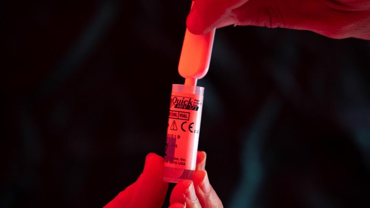 En la imagen de archivo, una persona se realiza una prueba rápida, anónima y gratuita de VIH. EFE