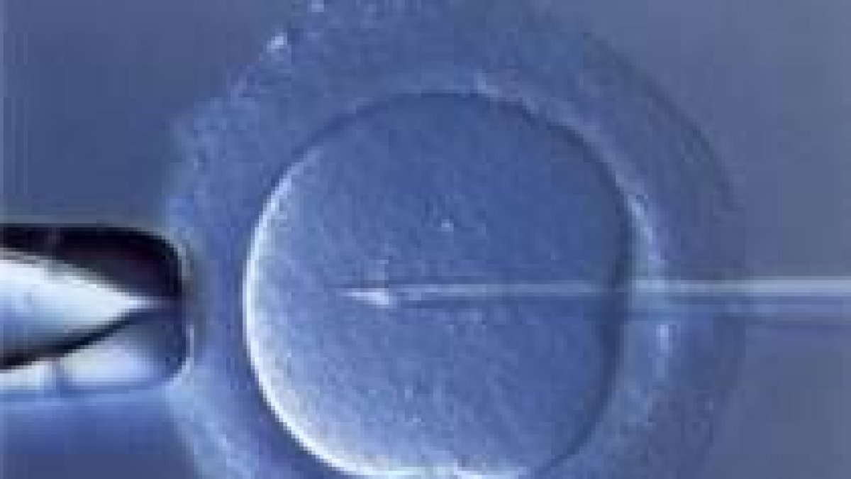 Técnica de microinyección inracitoplásmatica, la reproducción asistida