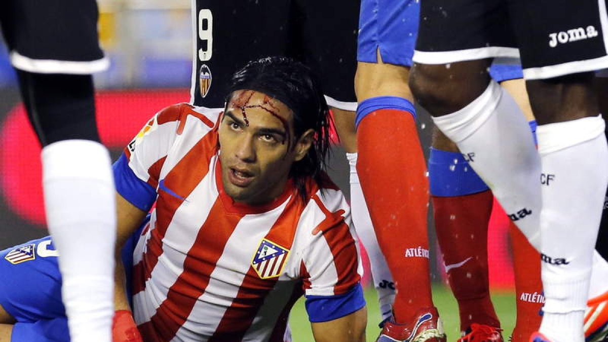 Falcao sangra por la cabeza tras un encontronazo.