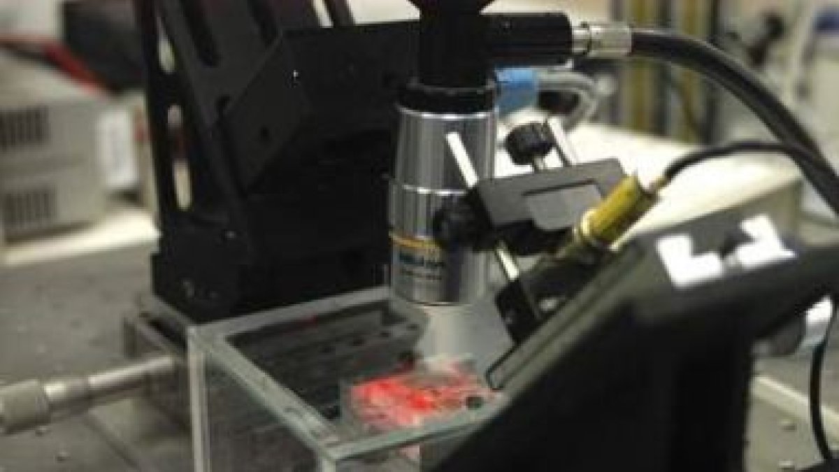 Equipo diseñado por científicos del CSIC para la detección precoz de enfermedades