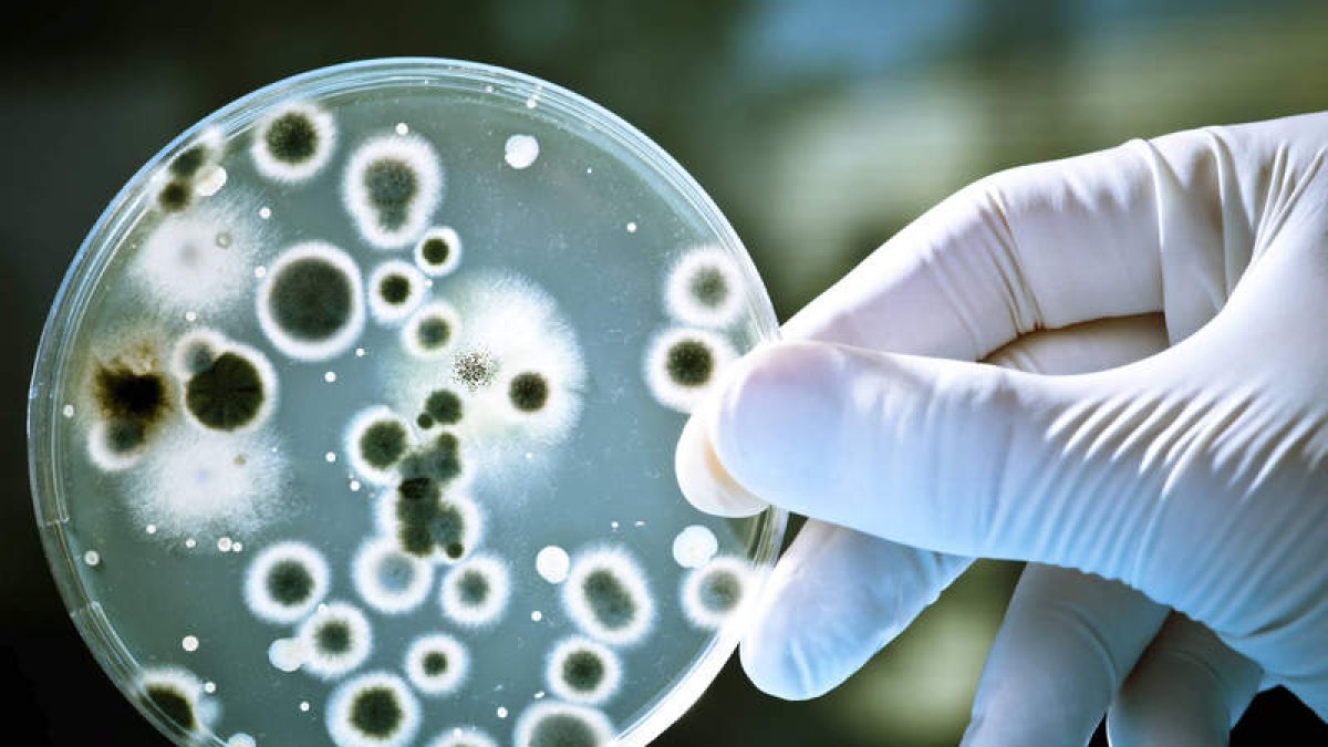Detalle de una cepa aislada en un laboratorio de la bacteria . DL