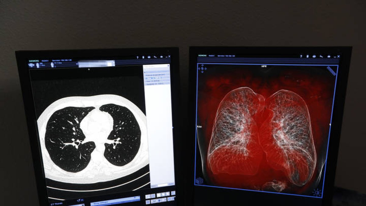 Vista de la consulta de un neumólogo leonés. MARCIANO PÉREZ