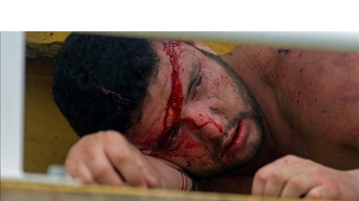 Un hincha del Paranaense, herido en la pelea entre aficiones.