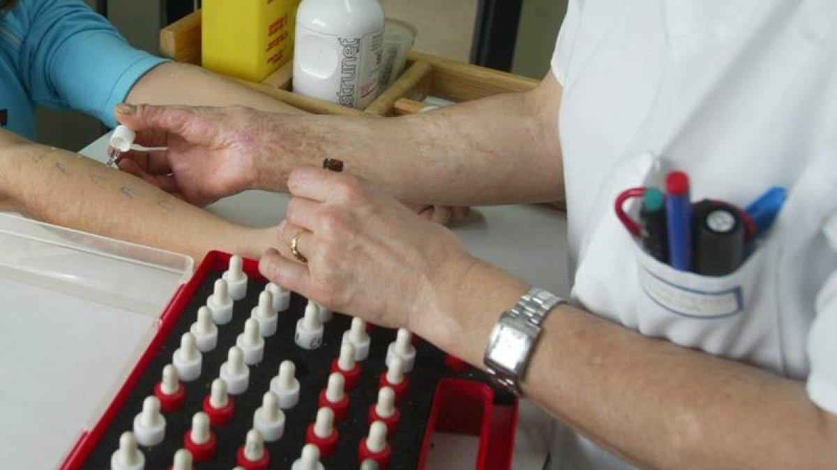Pruebas cutáneas en el servicio de Alergología del Hospital de León. JESÚS F. SALVADORES