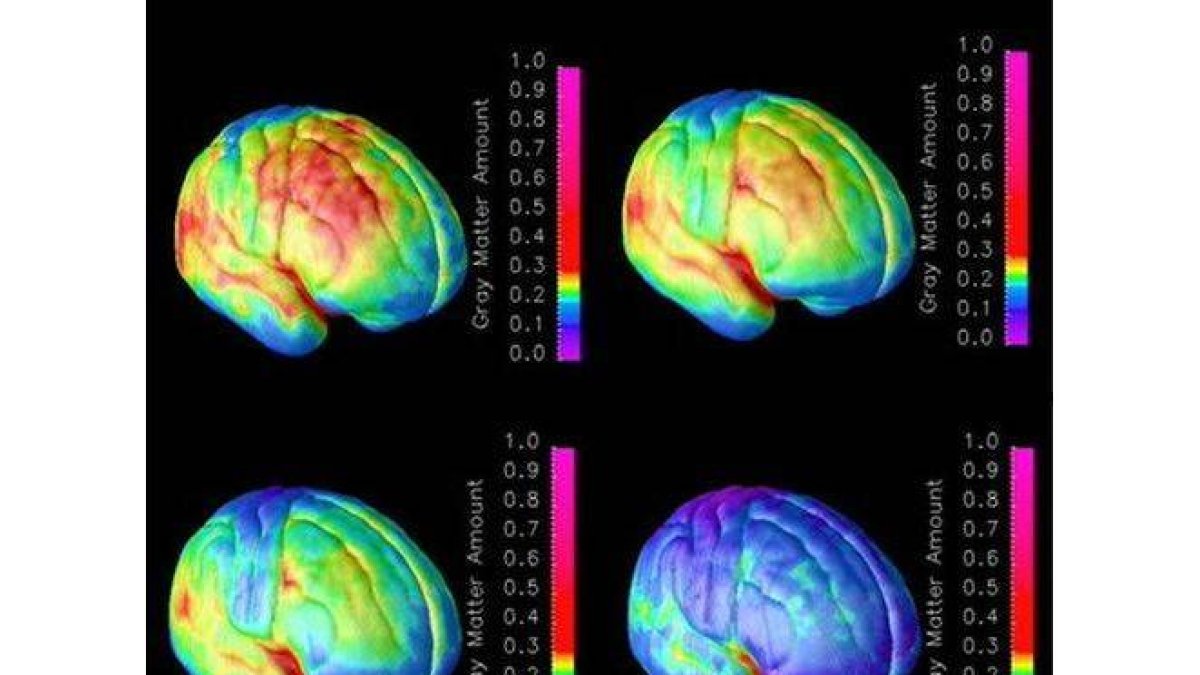 Combo de imágenes que muestran el proceso de maduración del cerebro.