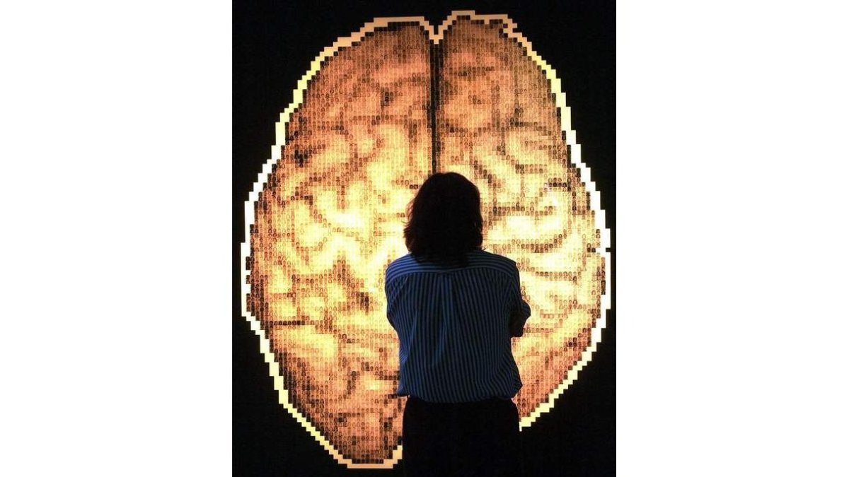 El proyecto se basa en técnicas de aprendizaje automáticos a través de neuroimágenes.