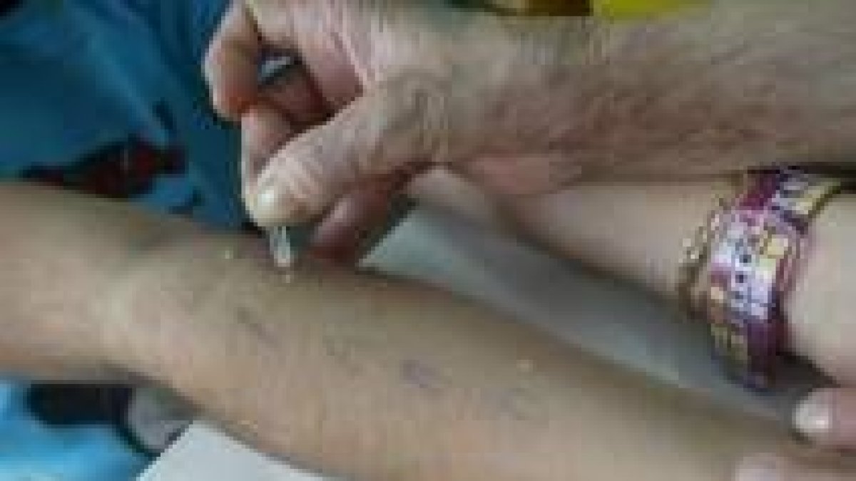 Una sencilla prueba descubrirá a lo que somos alérgicos
