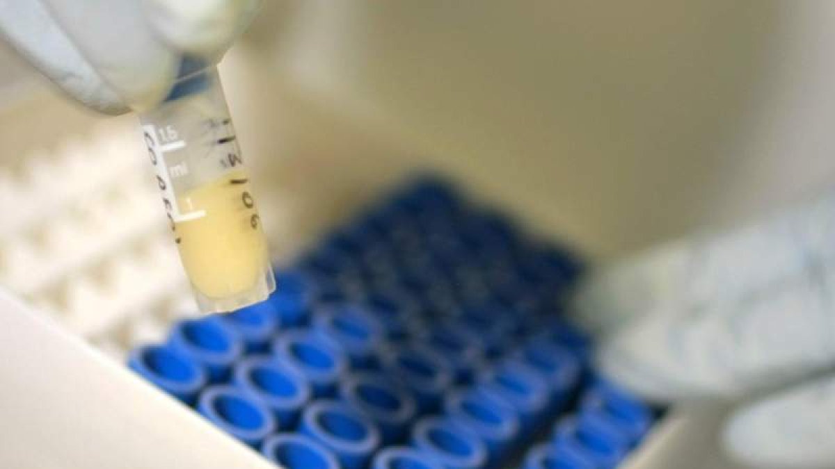 La terapia CART es el tratamiento con mejores resultados contra la leucemia. TIM WIMBORNE