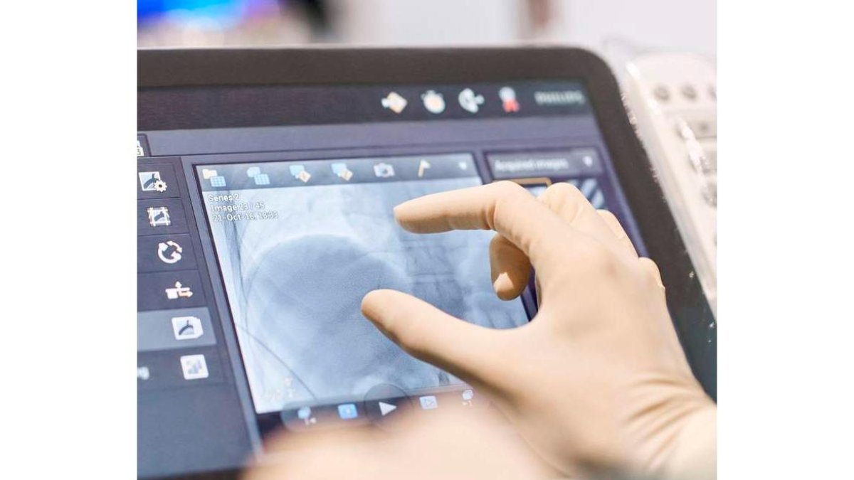 La implantación directa del tejido en el cuerpo evita problemas de rechazos e infecciones. r.p.