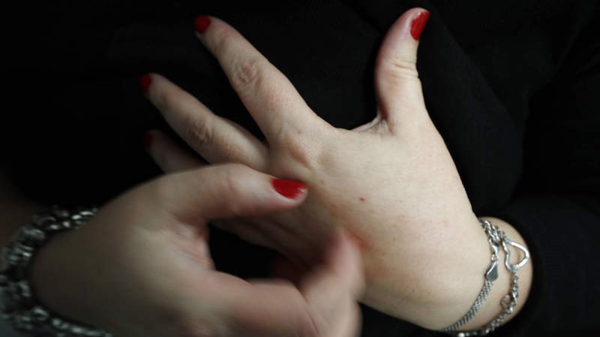Picor y dolor son dos de los síntomas característicos de la psoriasis.