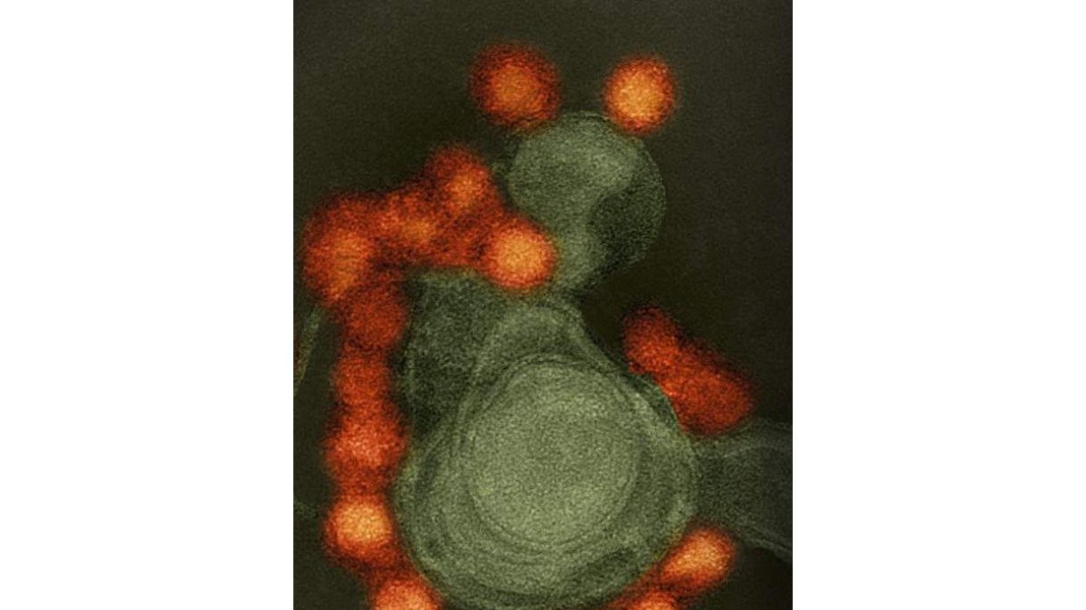 Vista del virus Zika, en rojo, junto a una célula. ARCHIVO