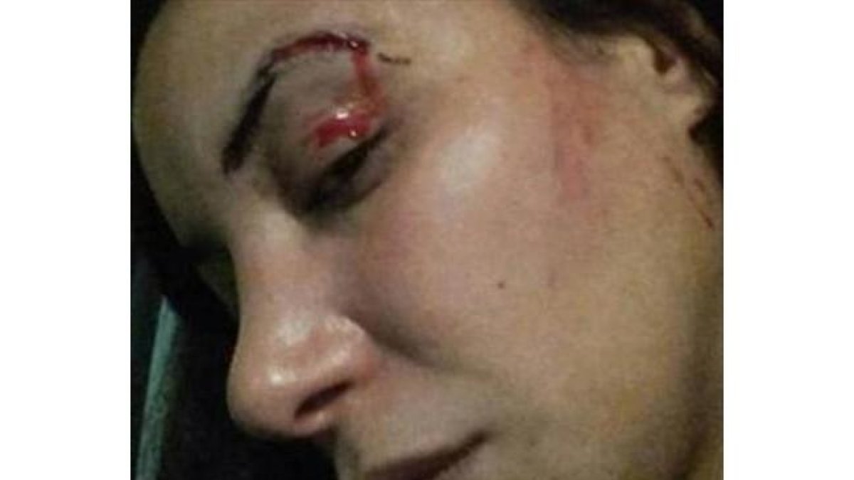 Imagen de la agresión a la actriz Lubna Avidar.