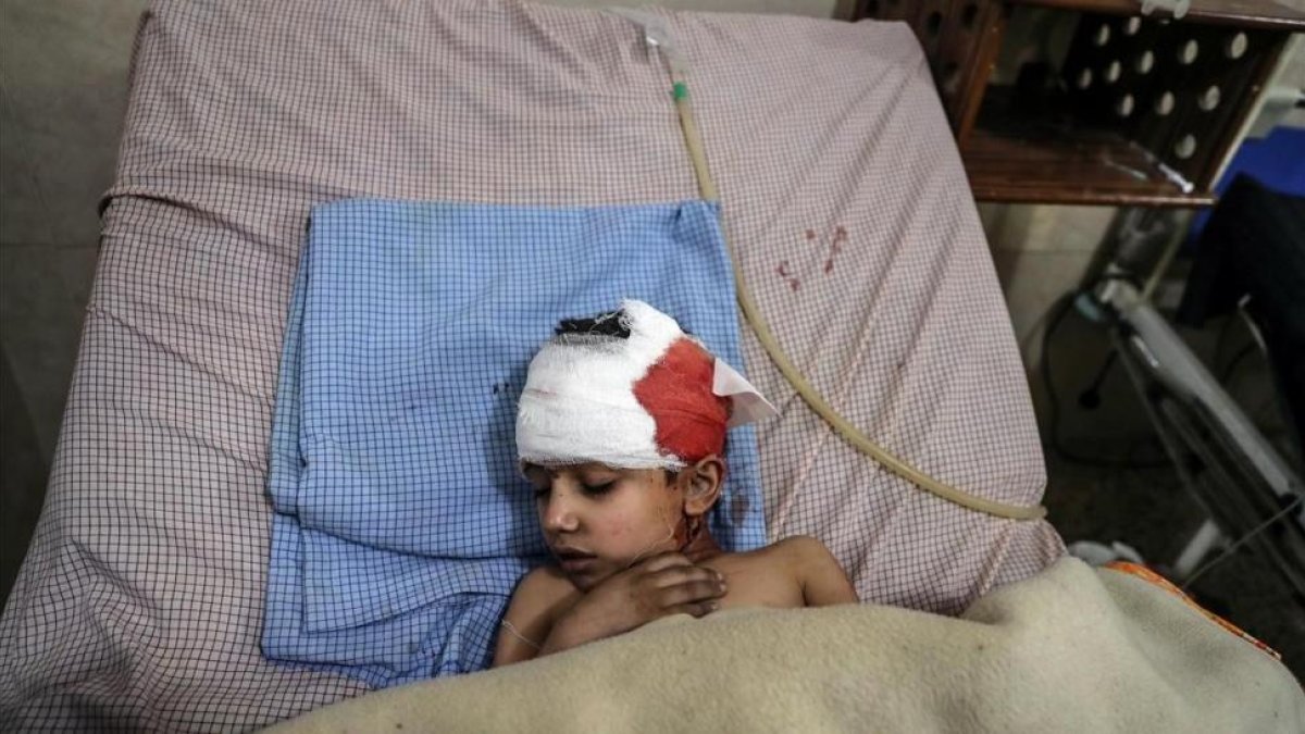 Un niño herido en los bombardeos de las fuerzas leales a Damasco recibe tratamiento en un hospital de Duma.
