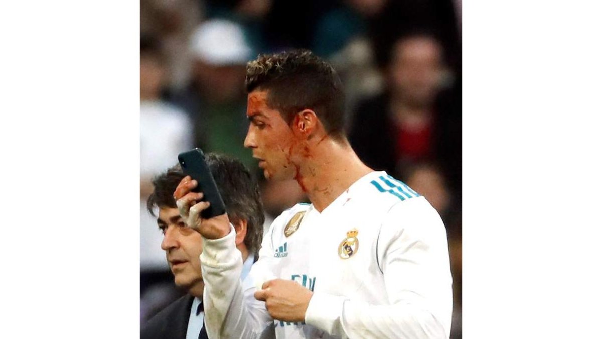 Cristiano se abrió la cabeza cuando remató en su segundo gol. RODRIGO JIMÉNEZ