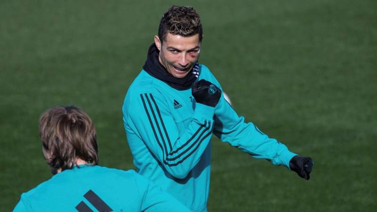 Cristiano Ronaldo aún arrastra las consecuencias del golpe que recibió cerca del ojo. RODRIGO JIMENEZ