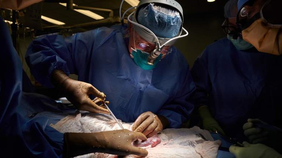 Trasplante en octubre de 2021 de un riñón de cerdo el hospital NYU Langone Health. DOMENICHO CHIAPPE